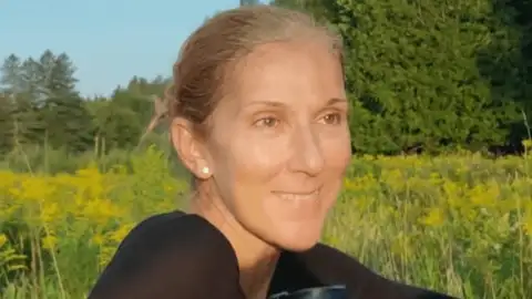 Céline Dion conviveu 17 anos com sintomas de doença rara antes do diagnóstico